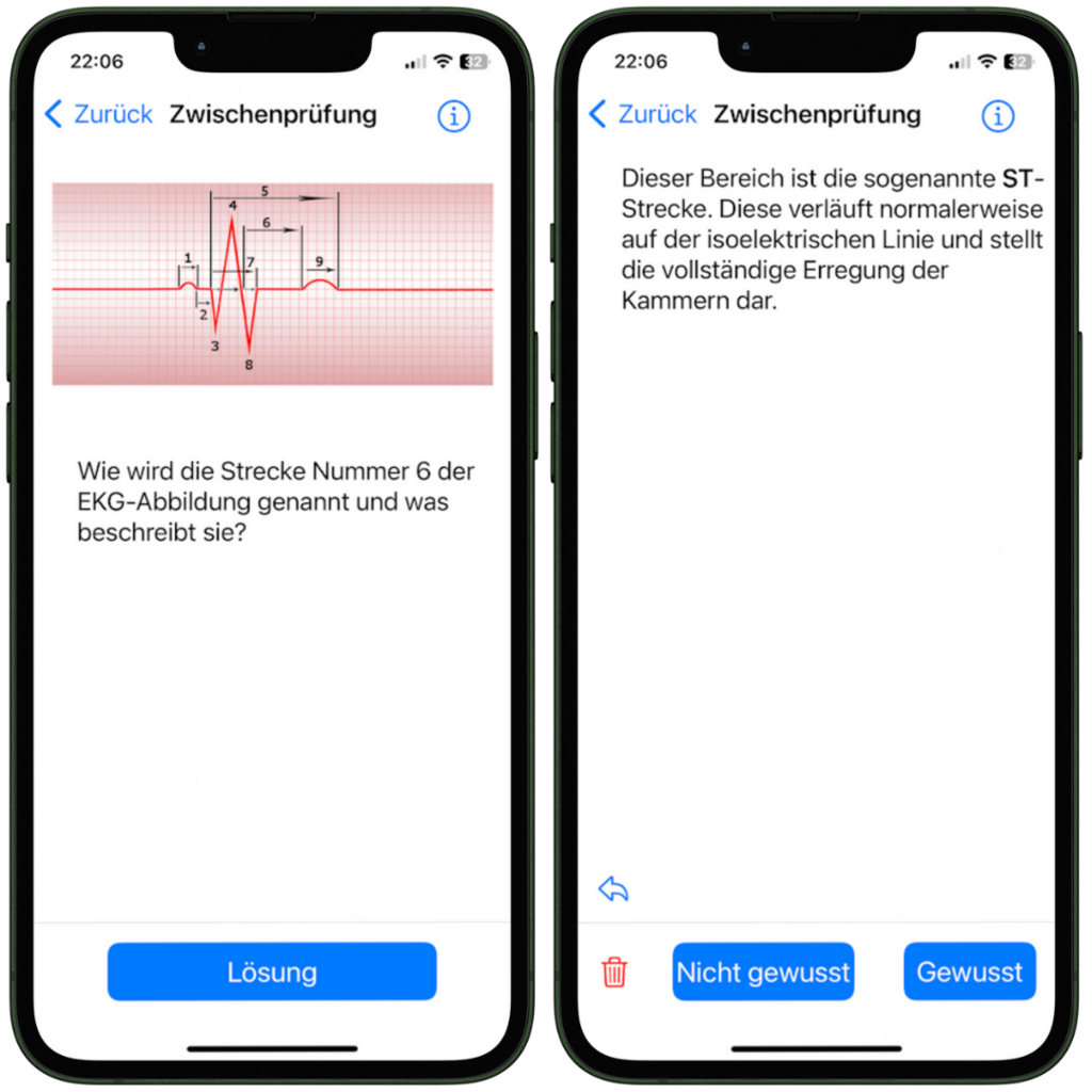 Darstellung einer Frage zu einem dargestellten EKG und der Antwort innerhalb der NotSan App