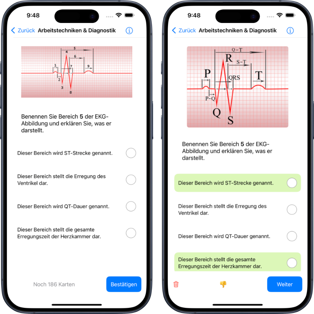 Darstellung einer EKG Abbildung als Multiple Choice mit Antwort innerhalb der NotSan App